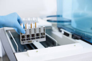 Types Of Chromatography