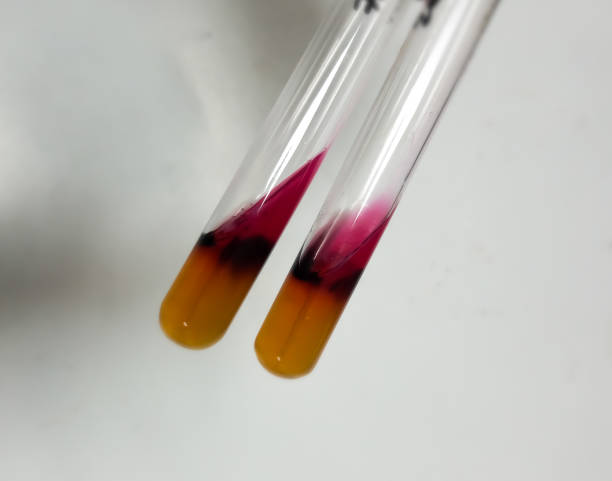 Hydrogen Carbonate Indicator