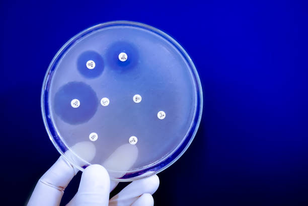Petri dish