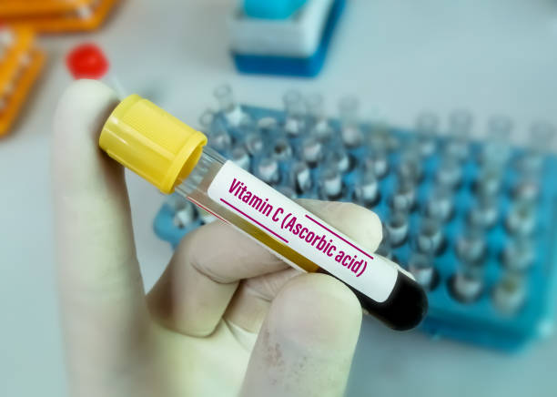 Vitamin C Test