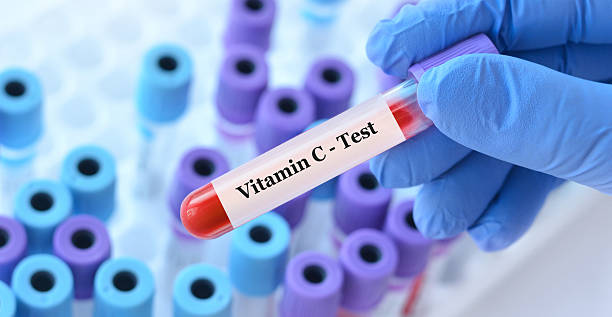 Vitamin С test